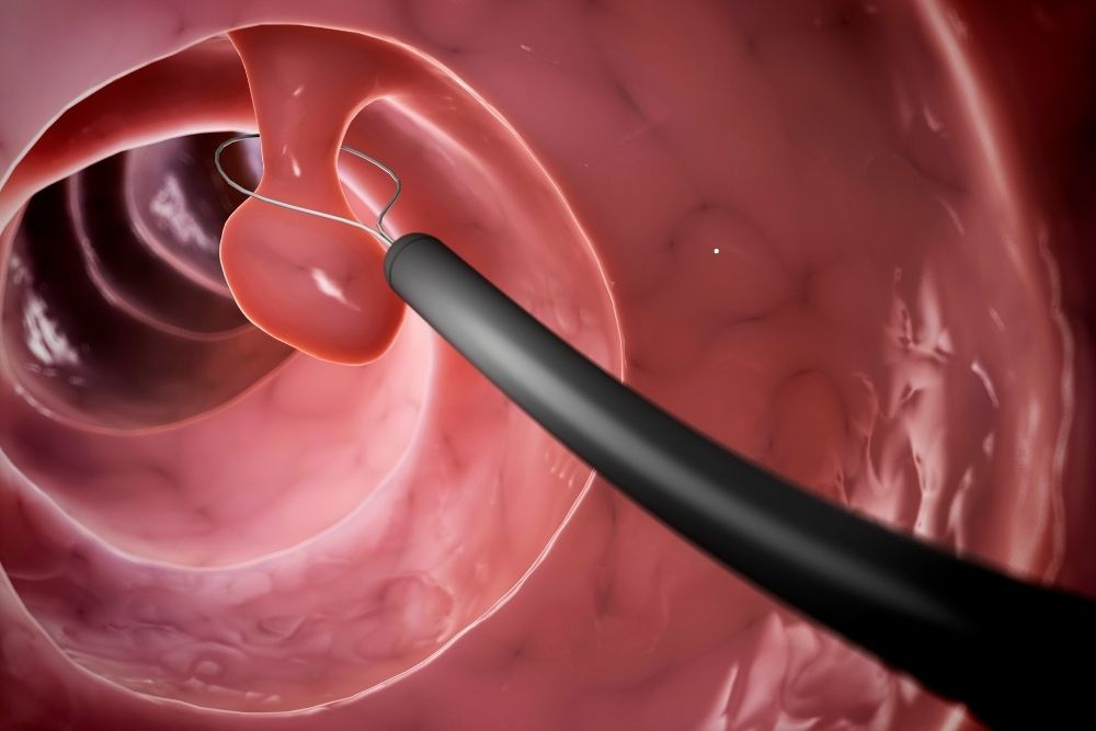 hamileyken-endoskopi-yapilir-mi