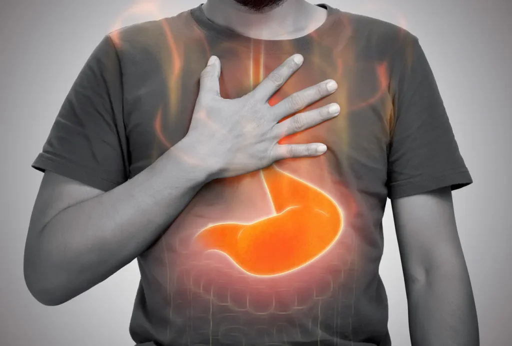 reflusu-olan-tup-mide-ameliyati-olabilir-mi