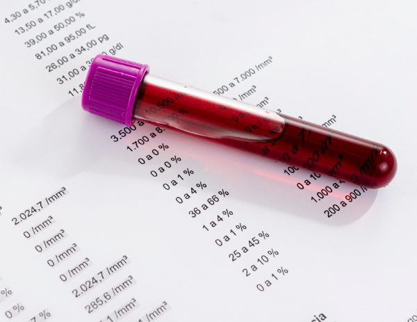 Tüp Mide Ameliyatı Öncesi Hangi Testler Yapılır? 4 tam kan sayimi testi nedir neden yapilir